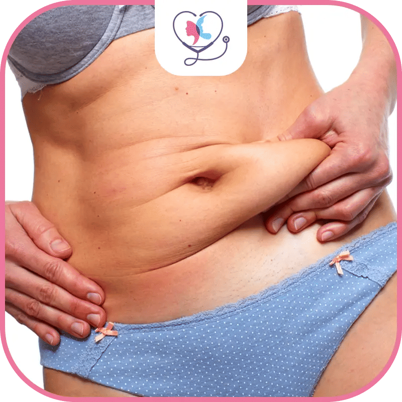 أضرار عملية شد البطن