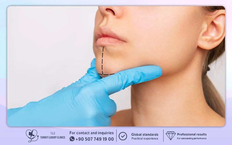 Is V-Line Surgery in Turkey Safe?