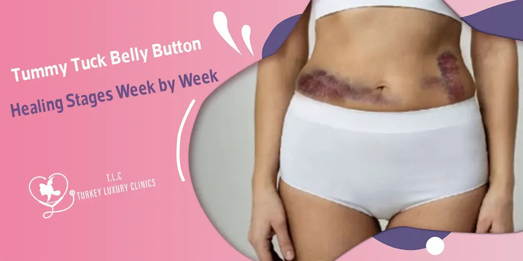 Abdominoplastia: Cicatrización del Ombligo Semana a Semana
