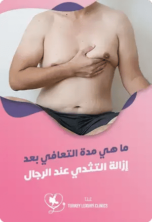 ما هي مدة التعافي بعد عملية التثدي عند الرجال؟featured image