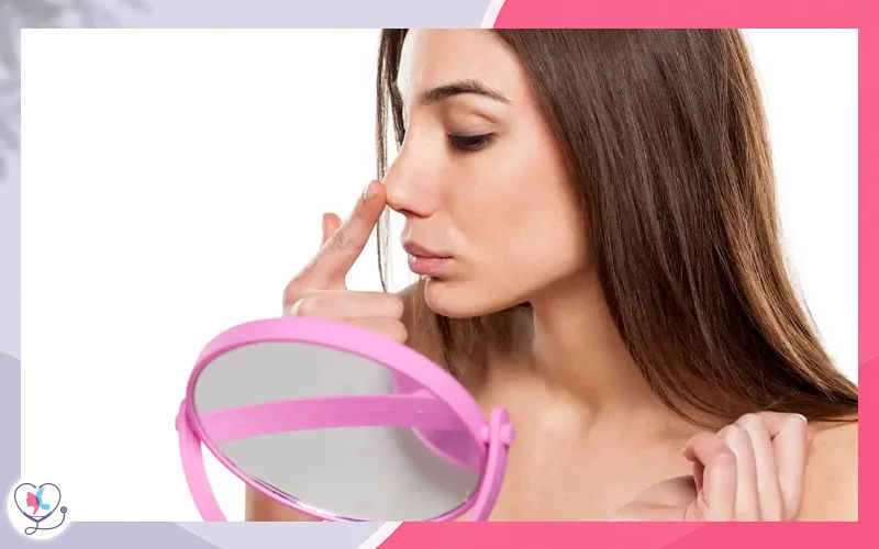 متى تصغر أرنبة الأنف بعد عملية التجميل؟