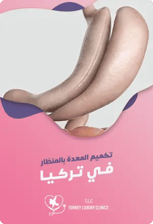 تكميم المعدة بالمنظار في تركياfeatured image