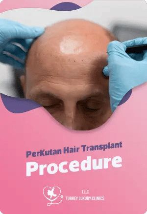 Perkutan Hair Transplant Procedurefeatured image