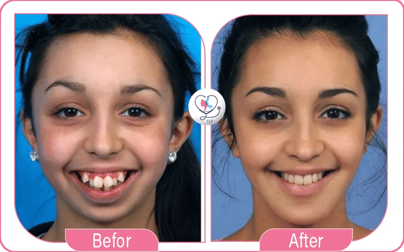 Chirurgie maxillo-faciale en turquie