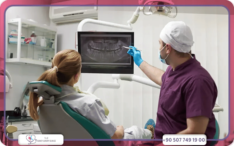 Les différentes étapes d’un implant dentaire