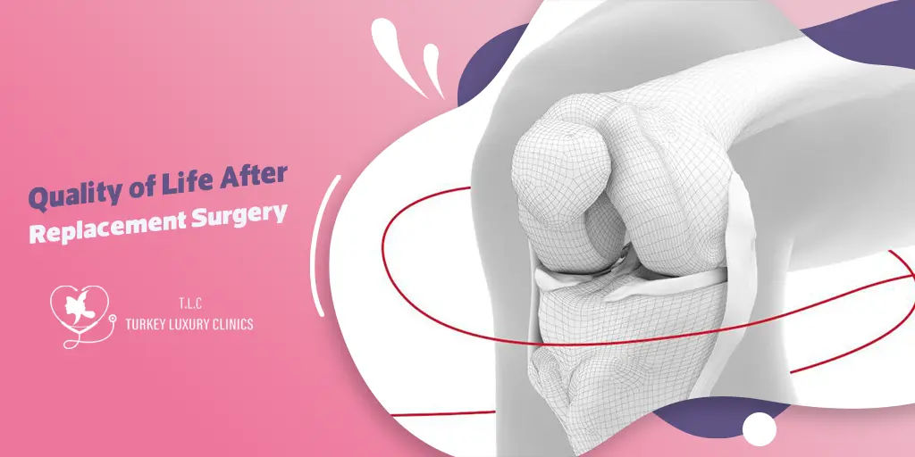 Quality of Life After Knee Replacement