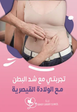 تجربتي مع شد البطن مع الولادة القيصرية: هل هذا ممكن؟