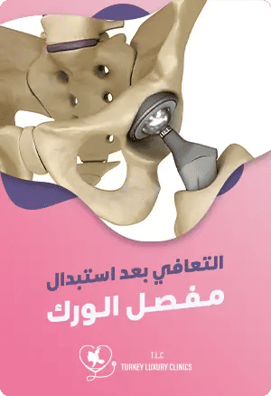 التعافي بعد استبدال مفصل الورك: الحياة بعد الجراحةfeatured image