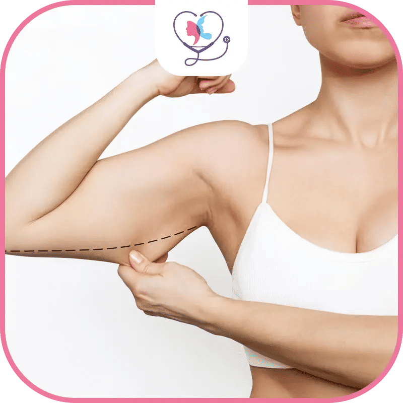 تكلفة عملية شد الذراعين في تركيا