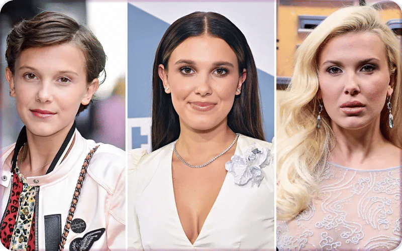 Actress Millie Bobby Brown showing changes in facial contours linked to cosmetic enhancements. Actress Millie Bobby Brown showing changes in facial contours linked to cosmetic enhancements.