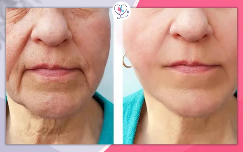 How Does Stem Cell Skin Care Work?