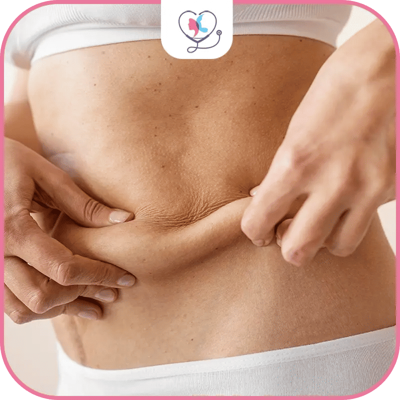 liposuccion vaser prix france - liposuccion vaser tarif