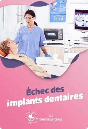 Échec des implants dentairesfeatured image