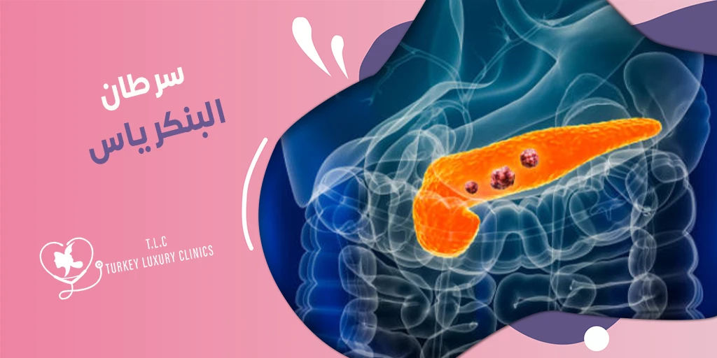 سرطان البنكرياس: ما هي الأعراض والأسباب وكيفية العلاج؟