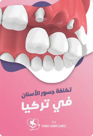 اسعار تركيب الاسنان في تركياfeatured image