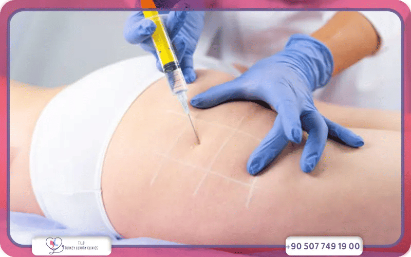 اسعار حقن الدهون الذاتيه في الارداف في مختلف الدول
