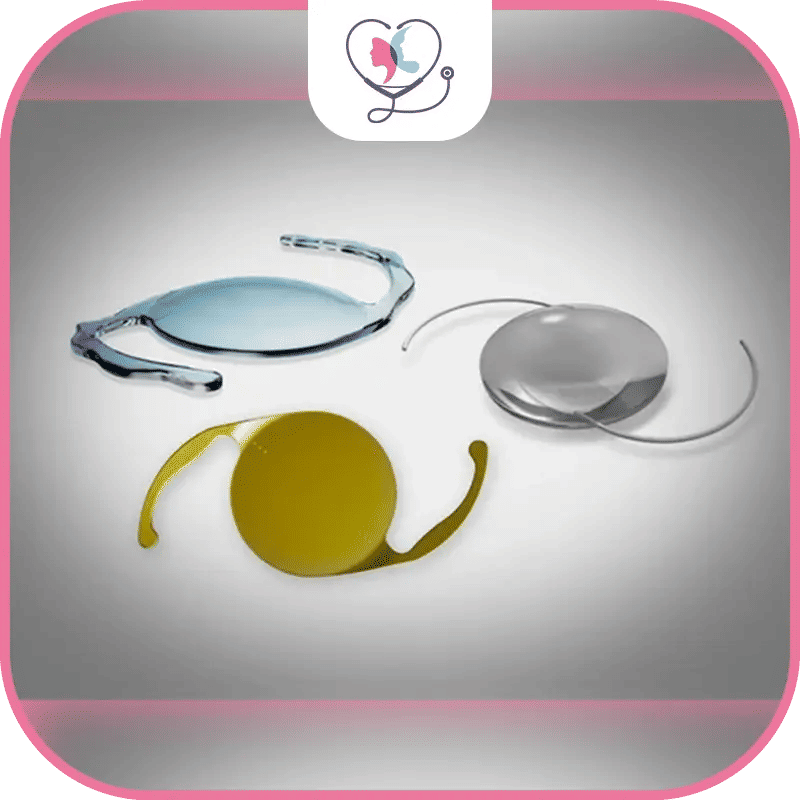 تكلفة زراعة العدسة الذكية في تركيا