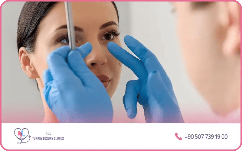 Les suites opératoires après une rhinoplastie ultrasonique