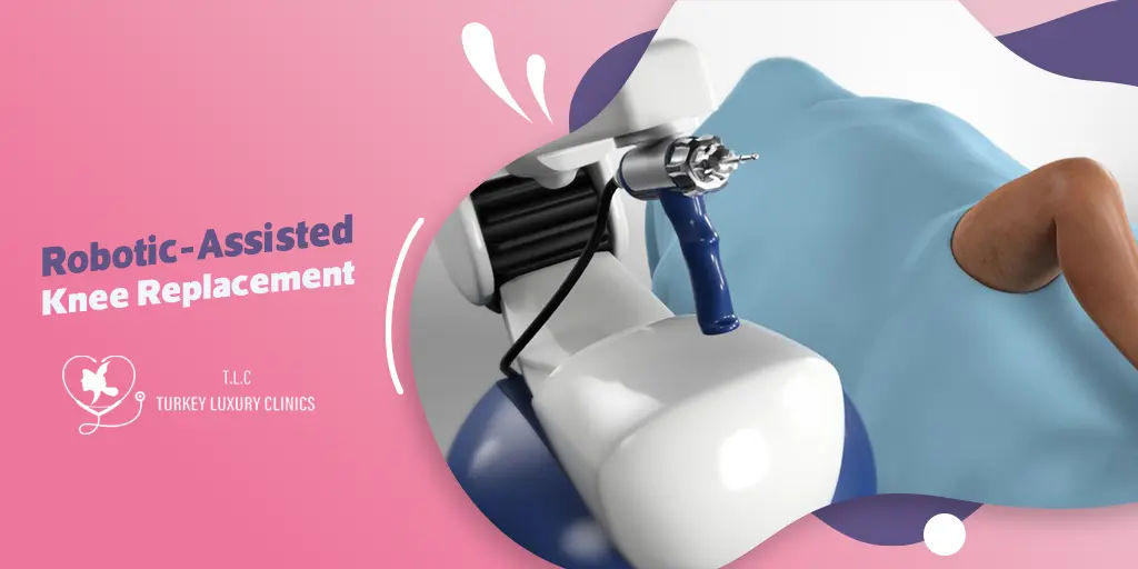 Robotic-Assisted Knee Replacement