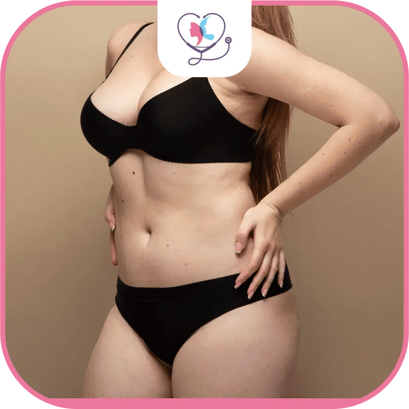 من هم المرشحون لشفط الدهون؟