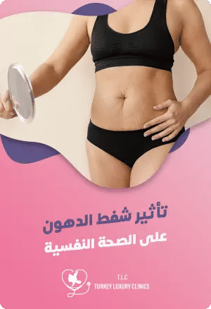 تأثير شفط الدهون على الصحة النفسيةfeatured image