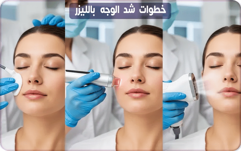 خطوات شد الوجه بالليزر