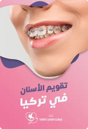 تقويم الأسنان في تركيا