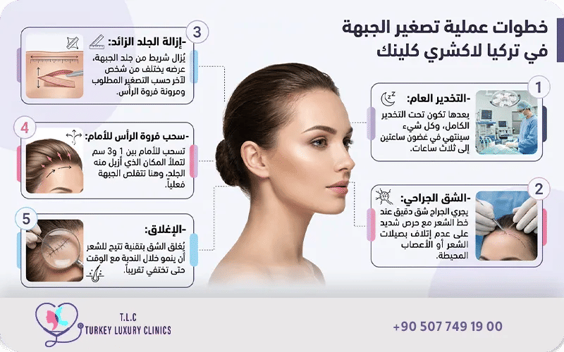 كيفية إجراء عملية تصغير الجبهة جراحياً؟