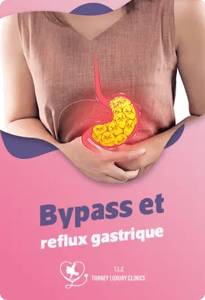 Bypass et reflux gastrique : Comprendre le lien et les solutions