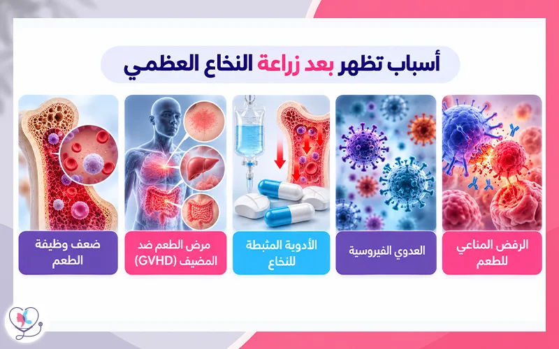 أسباب تظهر بعد زراعة النخاع العظمي