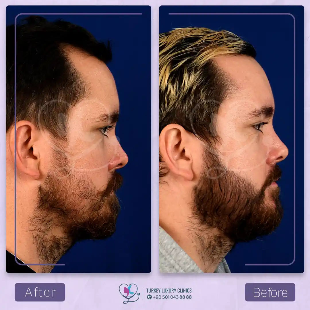 من الشهر السادس حتى السنة