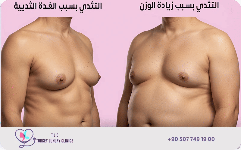 ما هو الفرق بين الجاينو والدهون