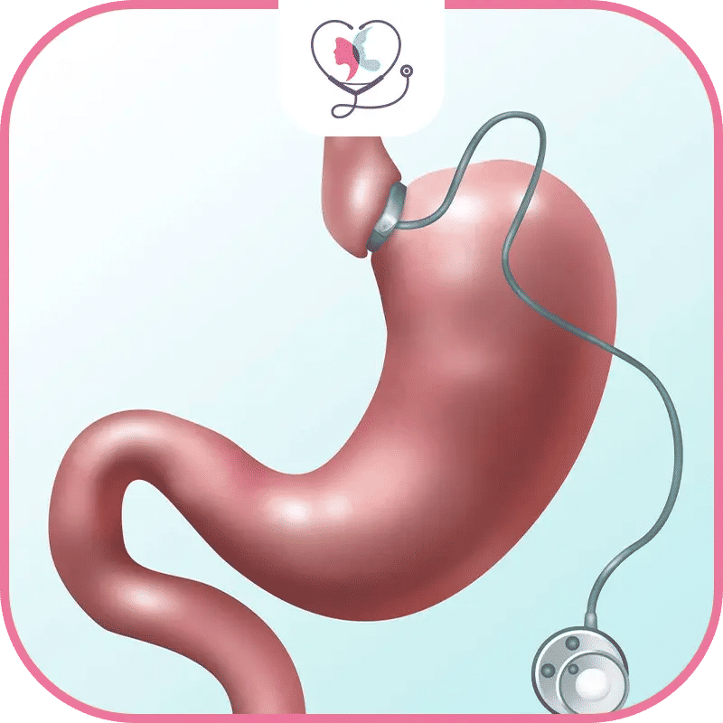 تكلفة عملية ربط المعدة في تركيا