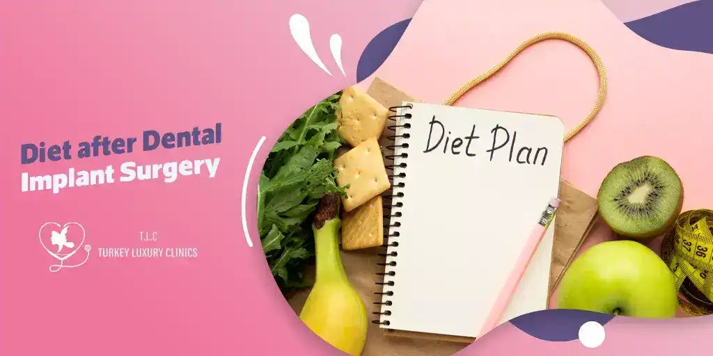 Diet After Dental Implant Surgery – Foods to Eat for Faster Recovery