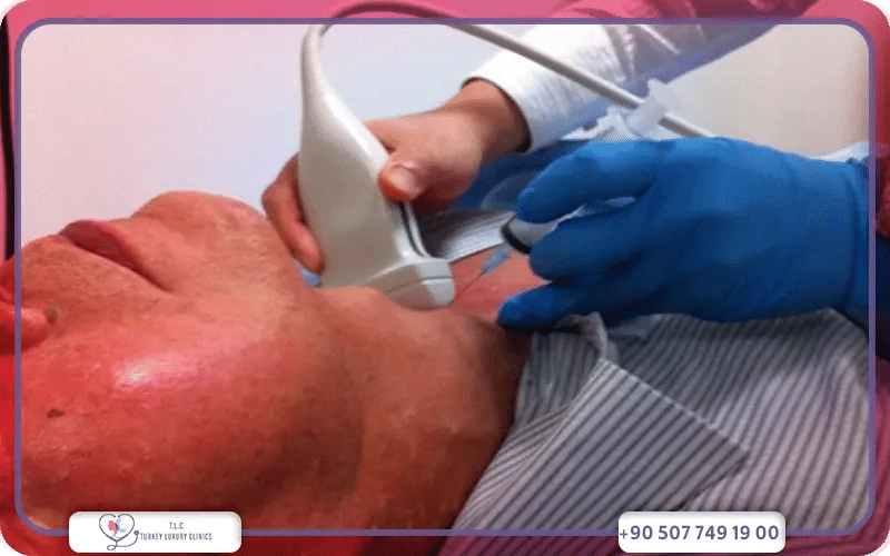 أعراض فرط نشاط الغدة الدرقية