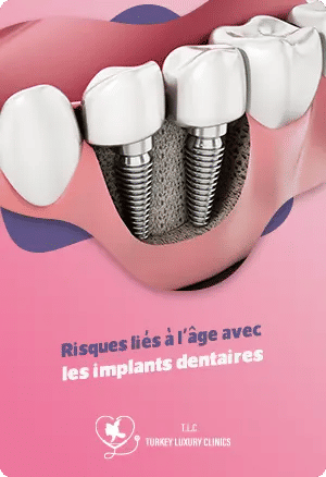 Risques liés à l'âge avec les implants dentaires