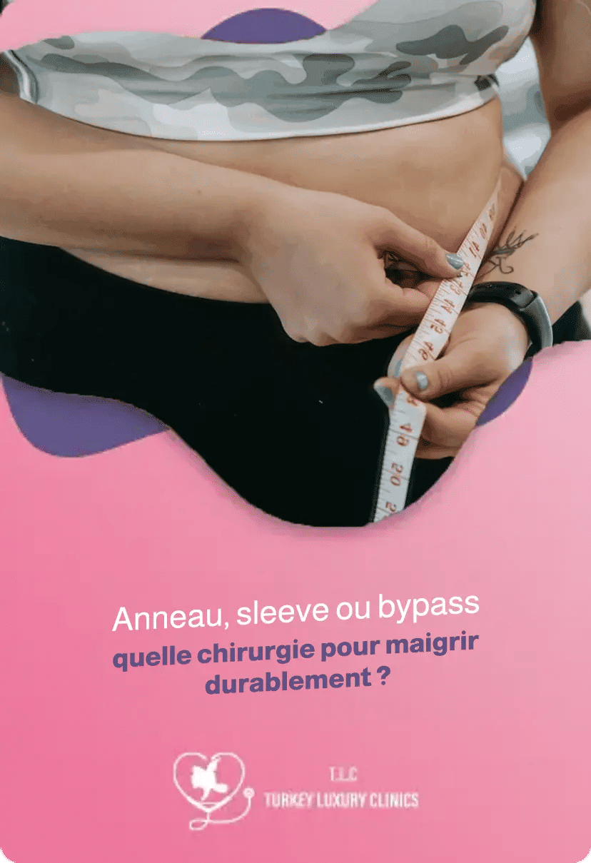 Anneau, sleeve ou bypass : quelle chirurgie pour maigrir durablement ?
