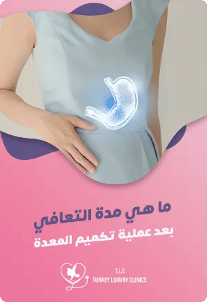 ما هي مدة التعافي بعد جراحة تكميم المعدة؟featured image