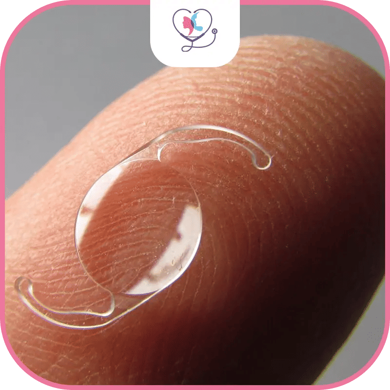 المرشحون لزراعة العدسة الذكية