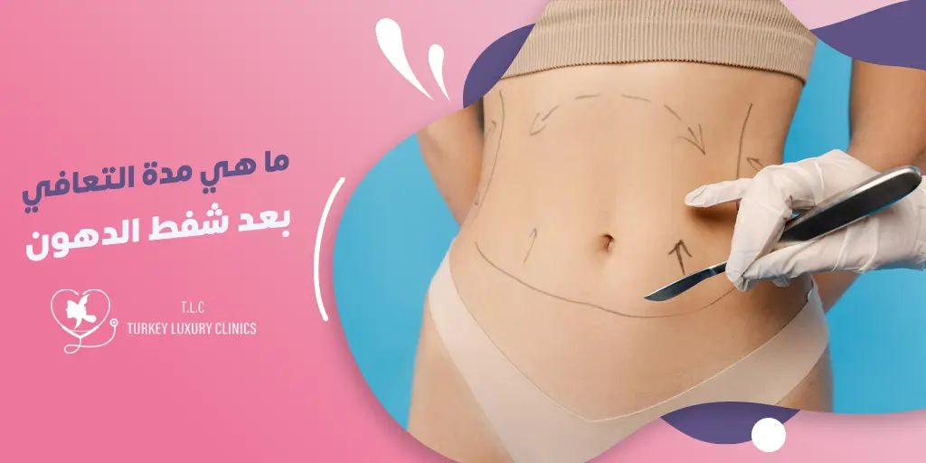 ما هي مدة التعافي بعد شفط الدهون؟