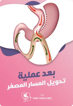 بعد عملية تحويل المسار المصغرfeatured image