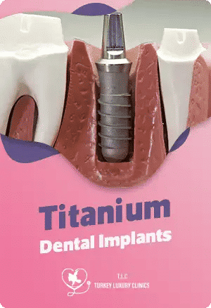 Титановые зубные имплантаты: надежное решение