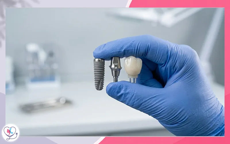 How Much Do Dental Implants Cost in Turkey in 2026?