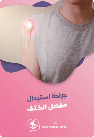 دليل كامل عن جراحة استبدال مفصل الكتف في تركياfeatured image