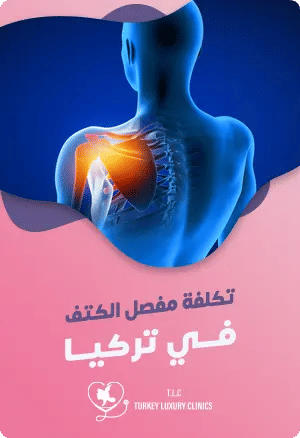 تكلفة استبدال مفصل الكتف في تركياfeatured image