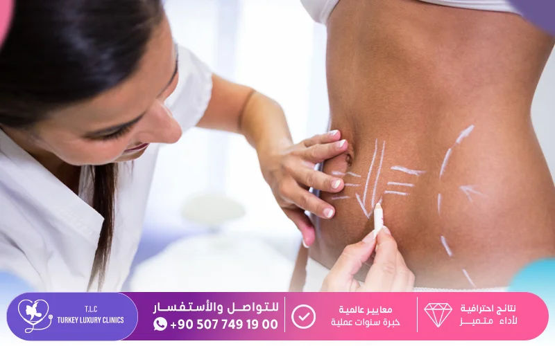 نصائح قبل عملية شد البطن