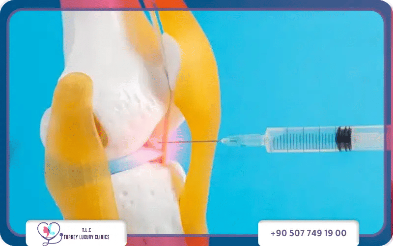 العوامل التي تؤثر على سعر حقن الركبة الهيالورونيك