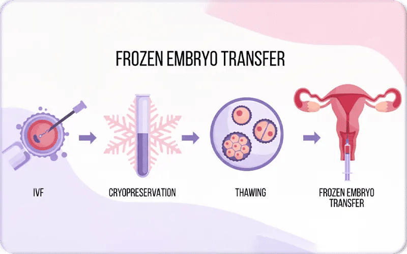 What Happens to Embryo After FET?