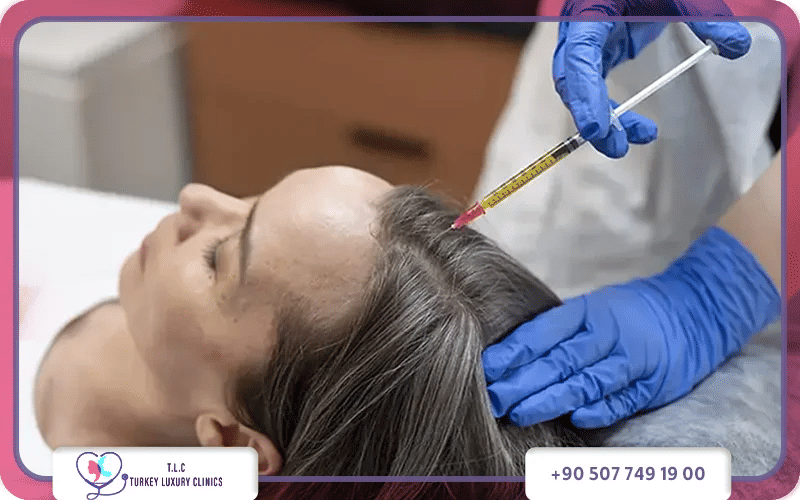 ثالثاً: الطرق الطبية الحديثة لعلاج فراغات الشعر