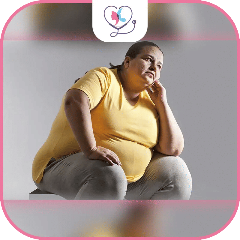 سيدة تعاني من السمنة المفرطة، توضح الآثار الصحية والنفسية للوزن الزائد